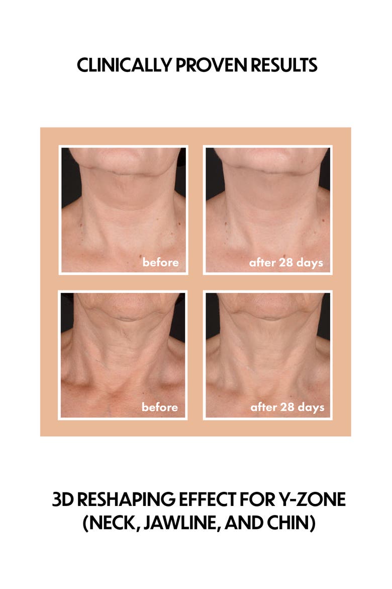 Neck Firming Complex with Bakuchiol, Alternate, color, NO COLOR