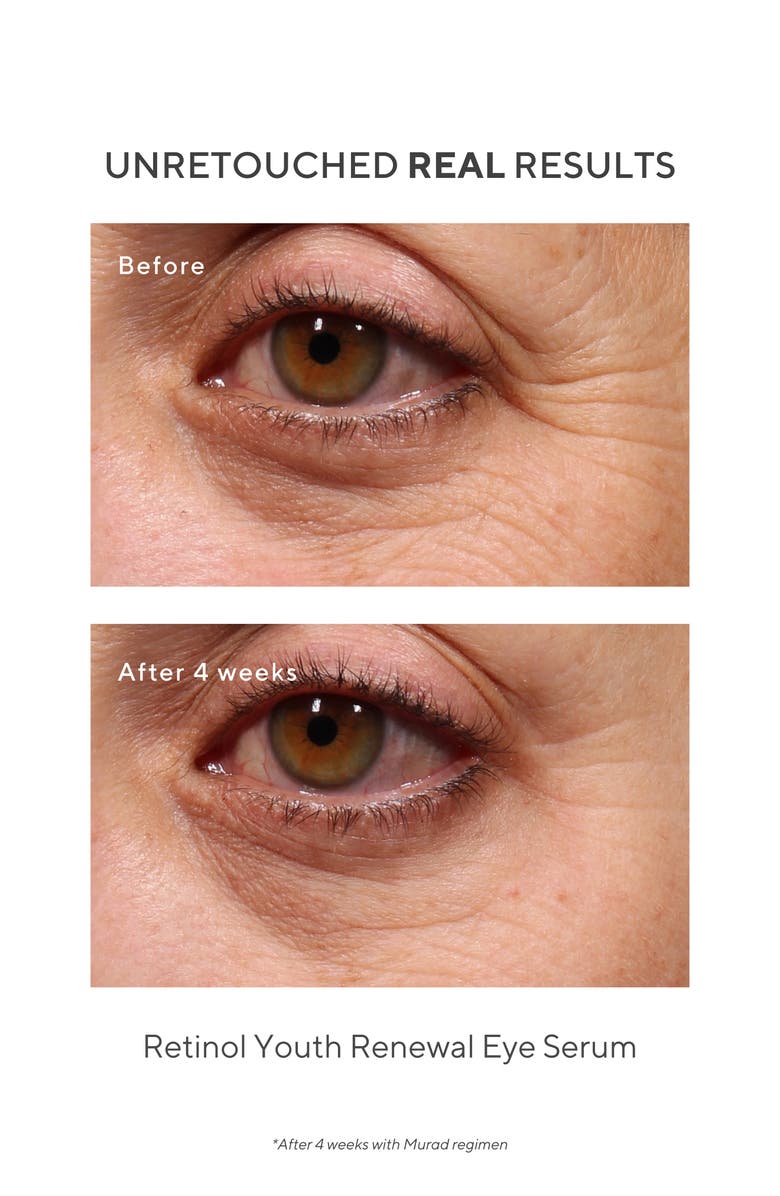 Murad<sup>®</sup> Retinol Youth Renewal Eye Serum, Alternate, color, 