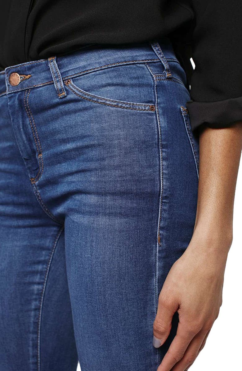 Topshop 'Leigh' Ankle Skinny Jeans, Alternate, color,
