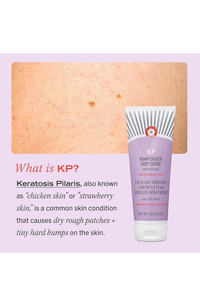 First Aid Beauty KP Bump Eraser Body Scrub, Alternate, color,