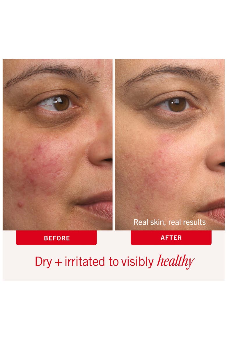 Jumbo Ultra Repair Cream for Intense Hydration $77 Value, Alternate, color, NO COLOR