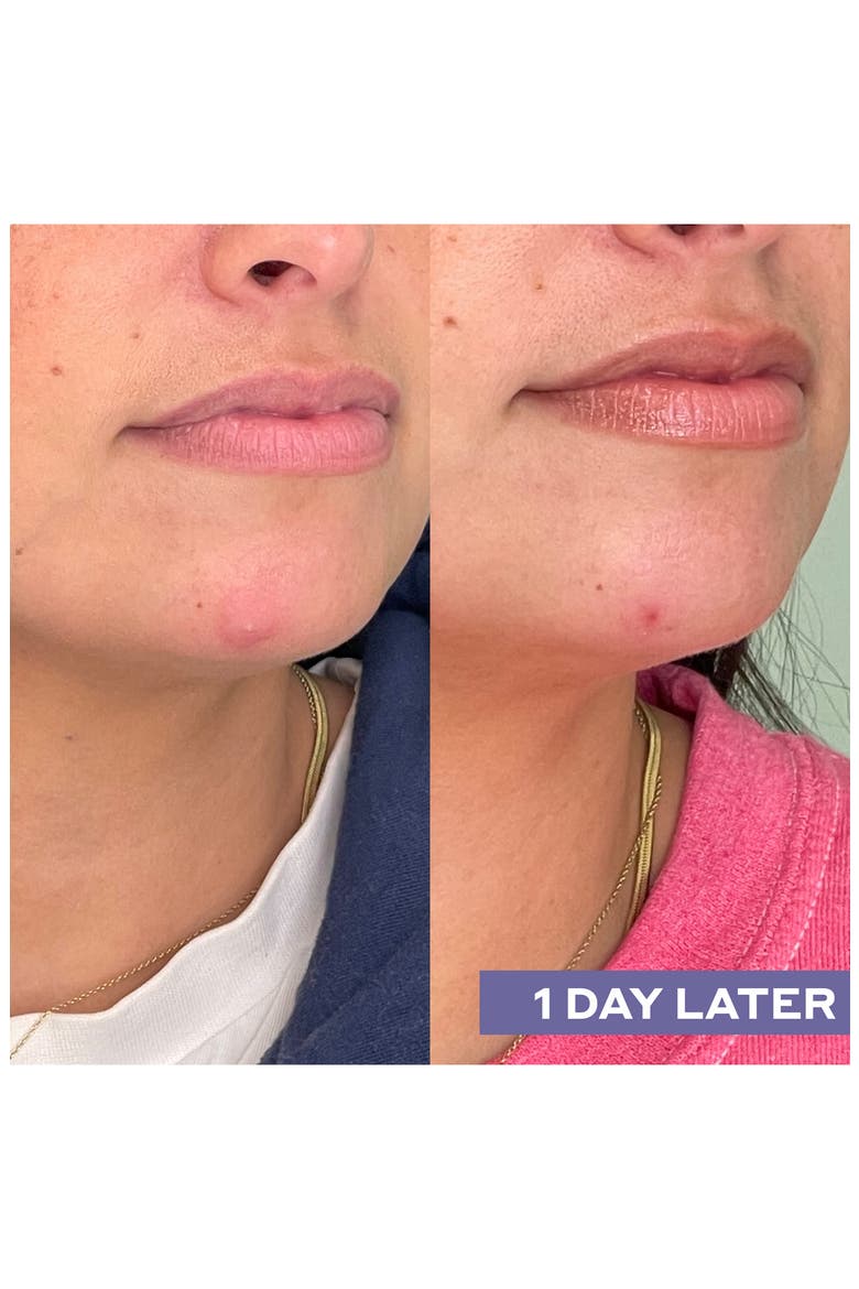 Repairing Facial Spray with Hypochlorous Acid, Alternate, color, NO COLOR