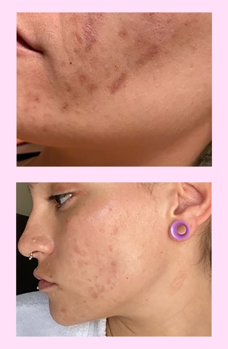 ROSEN Tropics Moisturizer, Alternate, color, 