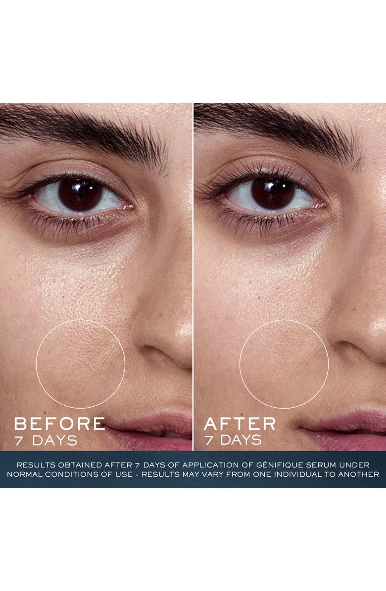 Lancôme Advanced Génifique Youth Activating Concentrate Anti-Aging Face Serum Duo Set (Limited Edition) USD $264 Value, Alternate, color,