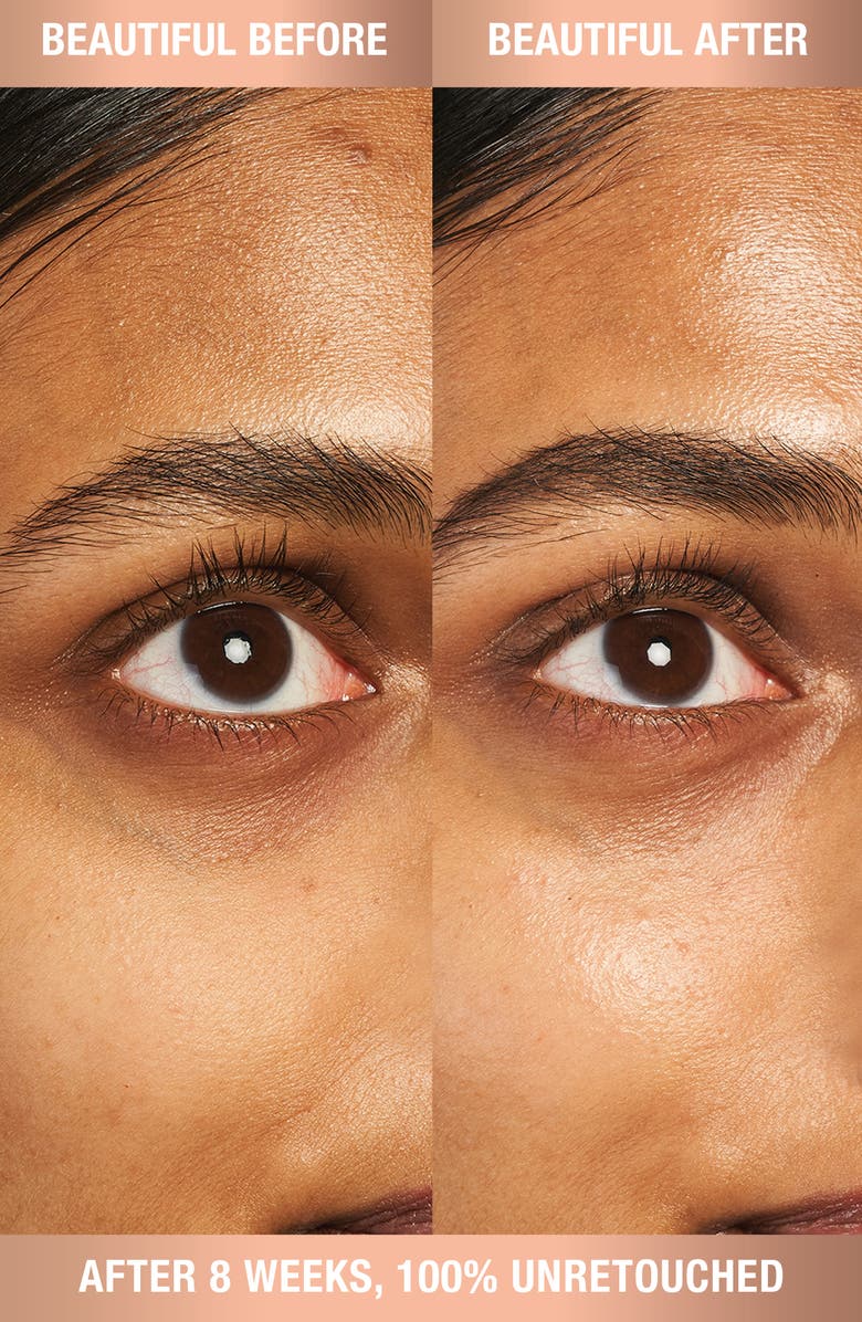 Charlotte Tilbury Refillable Magic Eye Rescue Cream with Retinol, Alternate, color, Jar