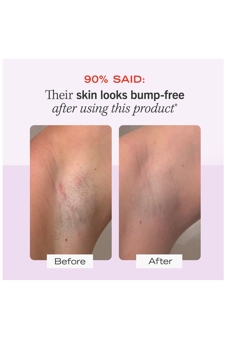 Ingrown Hair Pads with BHA & AHA, Alternate, color, NO COLOR