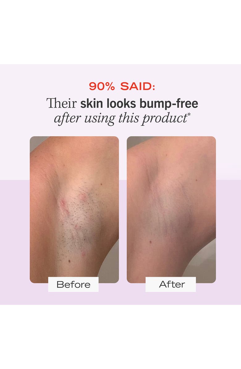 First Aid Beauty Ingrown Hair Pads with BHA & AHA, Alternate, color,