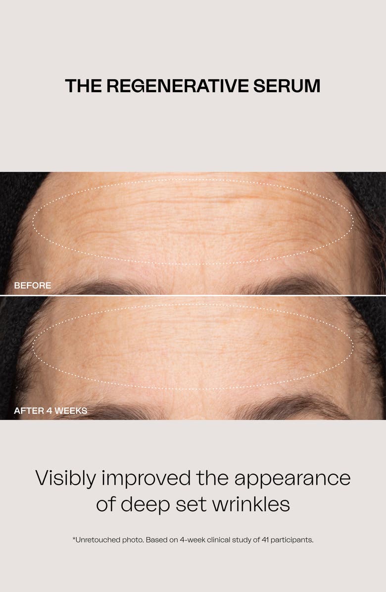 EIGHTH DAY The Ultimate Hydration Collection Set (Limited Edition) $357 Value, Alternate, color,