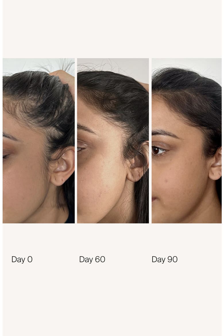 Scalp Care Density Serum, Alternate, color, NO COLOR