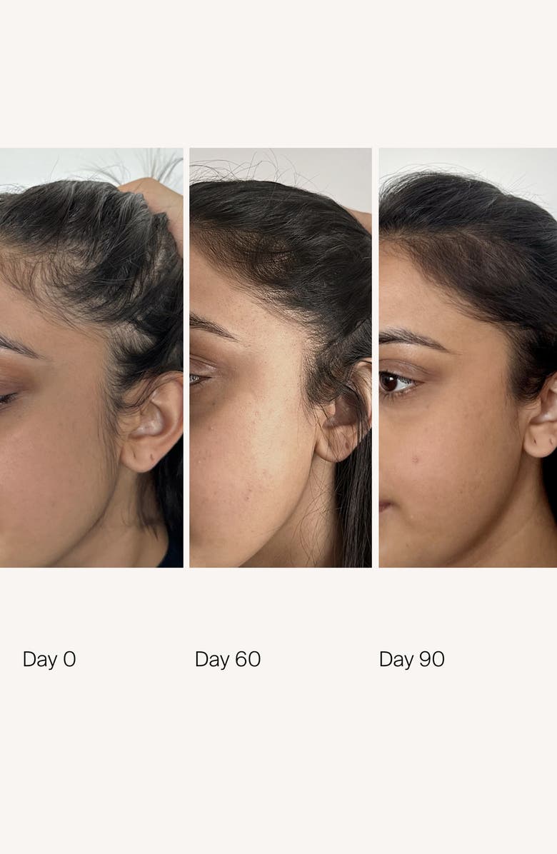 Living proof<sup>®</sup> Scalp Care Density Serum, Alternate, color,