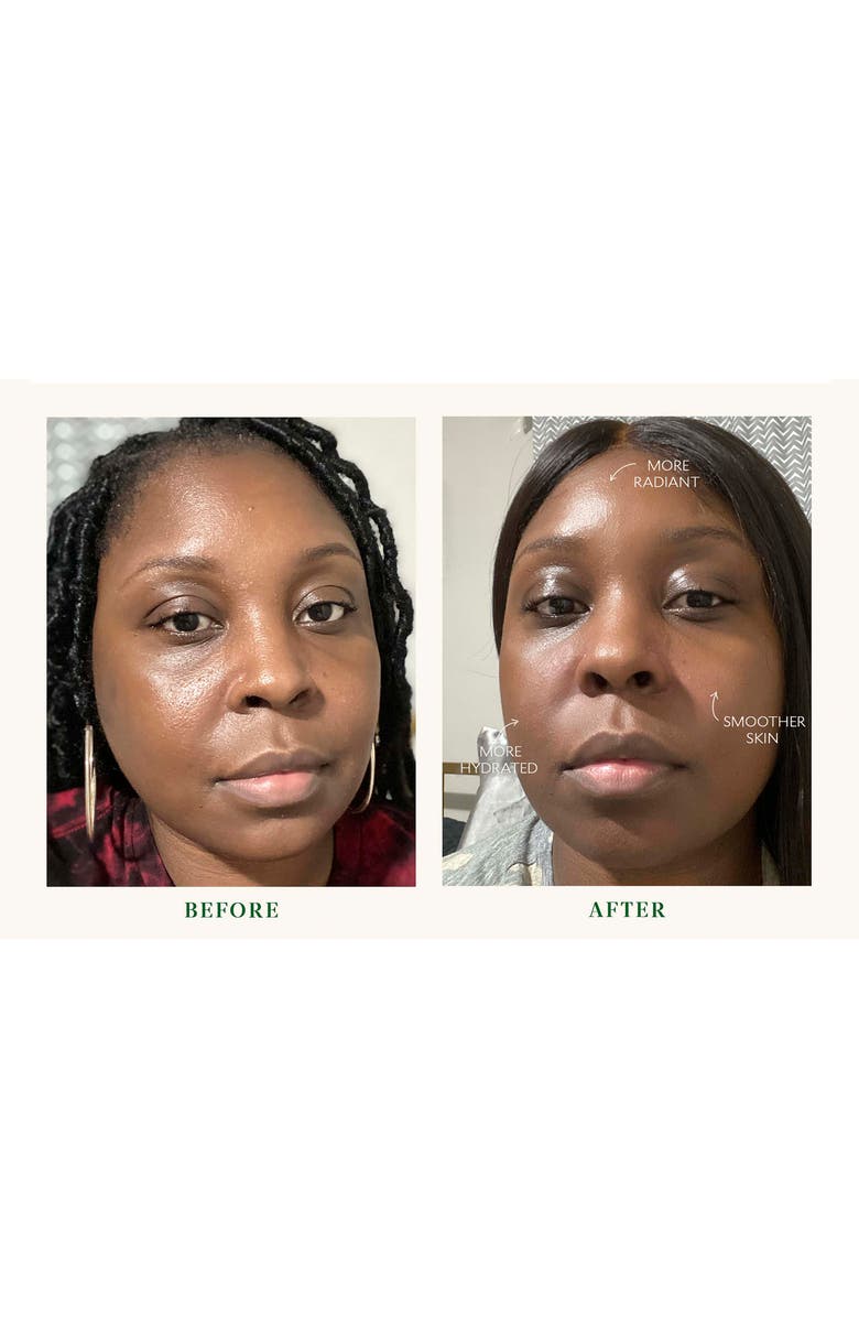 Tata Harper Skincare Bio-Barrier Serum, Alternate, color,